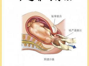 女人生孩子顺产全程：无侧切、无撕裂，顺产的秘密